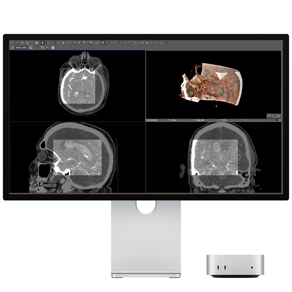 Studio Display - Image 3